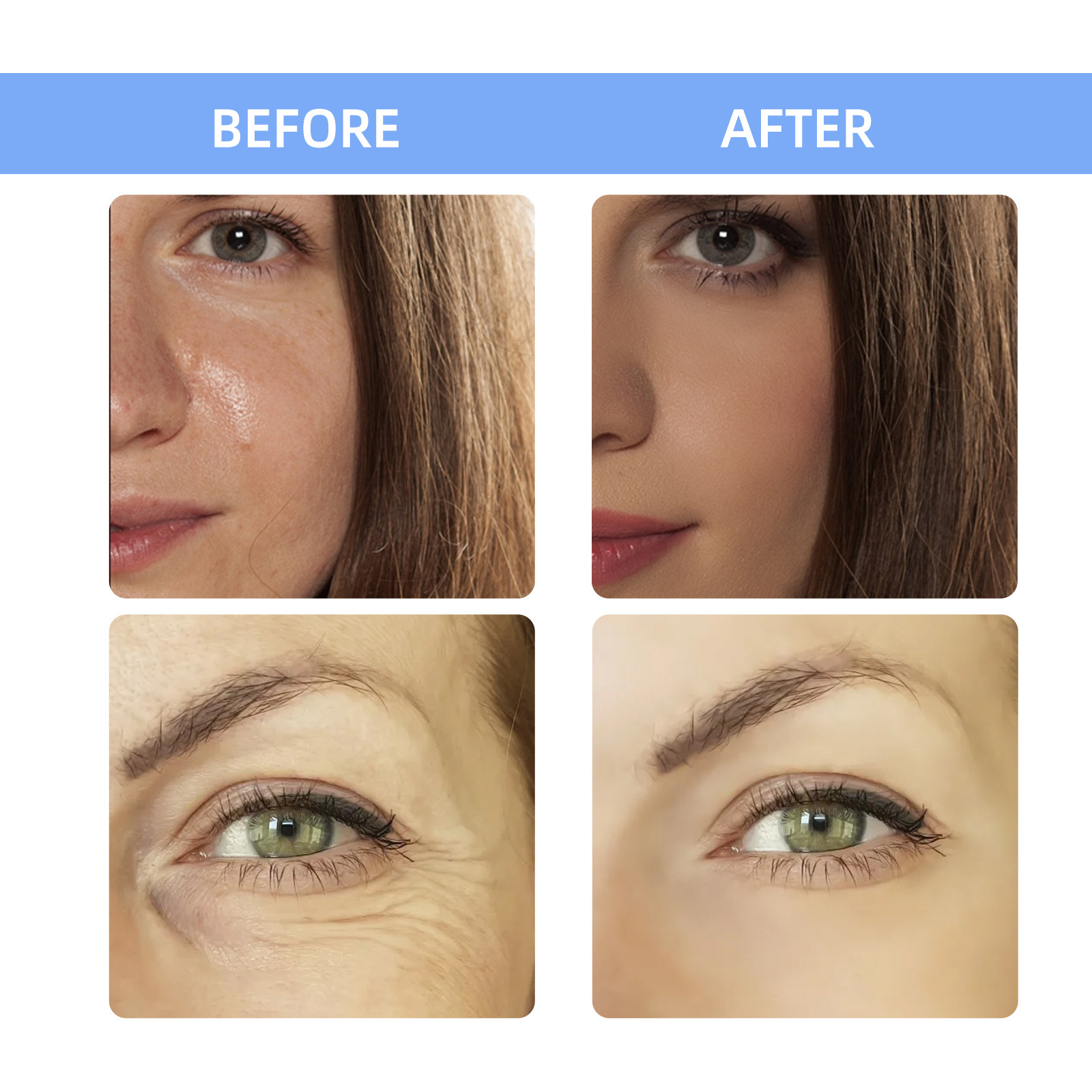 2ml * 7pcs Hyaluronic Acid Mes - Hyaluronic Acid Facial Serum บทวิจารณ์และราคา