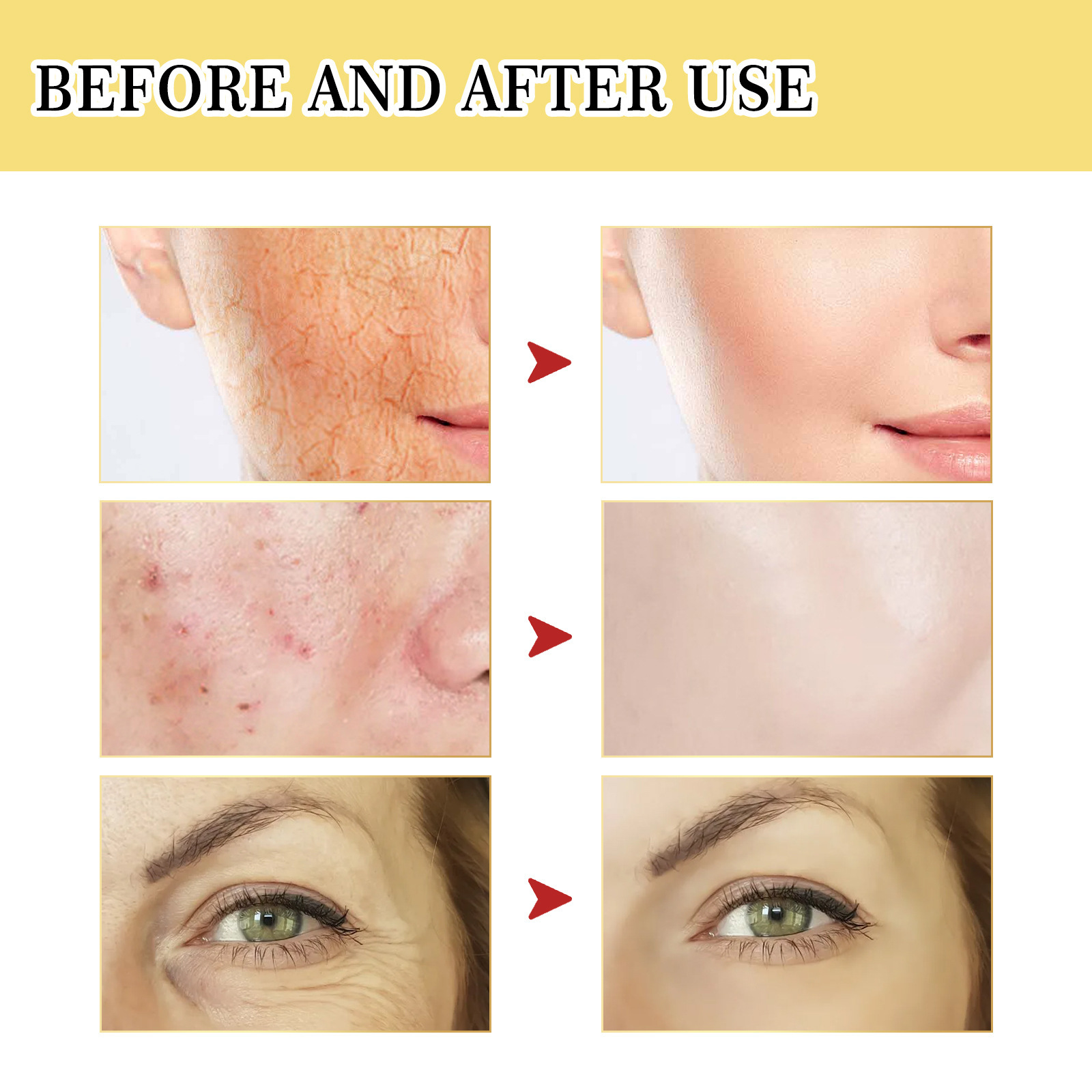 หอยทาก mucin 96% ซ่อมแซมสาระสำ - Snail Mucin 96 Repair Essence บทวิจารณ์และราคา