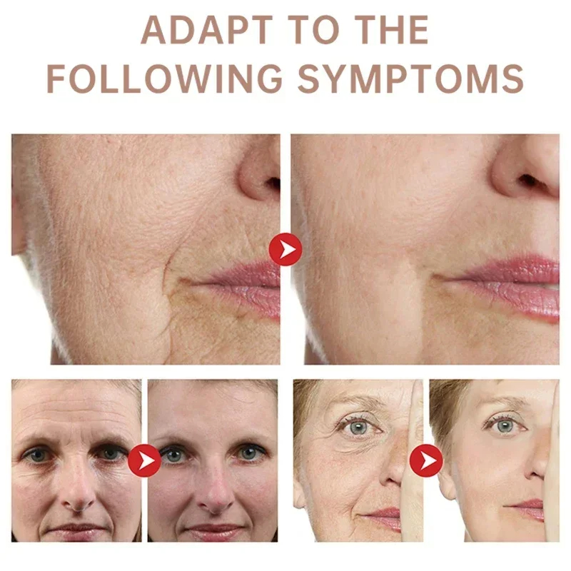 ลบริ้วรอยครีม Retinol Face Ant - Retinol Anti Wrinkle Cream บทวิจารณ์และราคา
