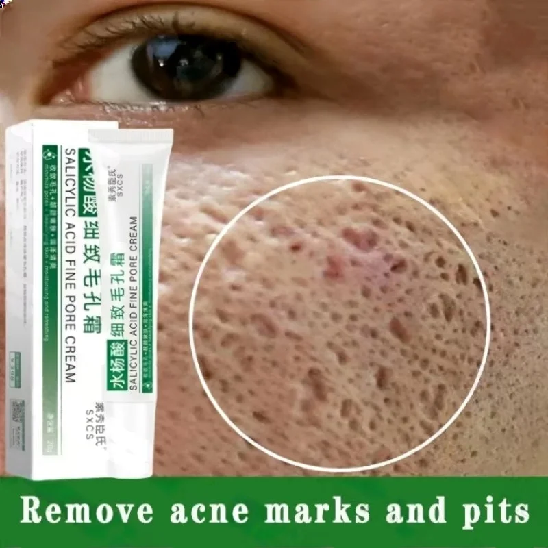 Salicylic Acid Pore Clearing C - Salicylic Acid Blackhead Remover บทวิจารณ์และราคา