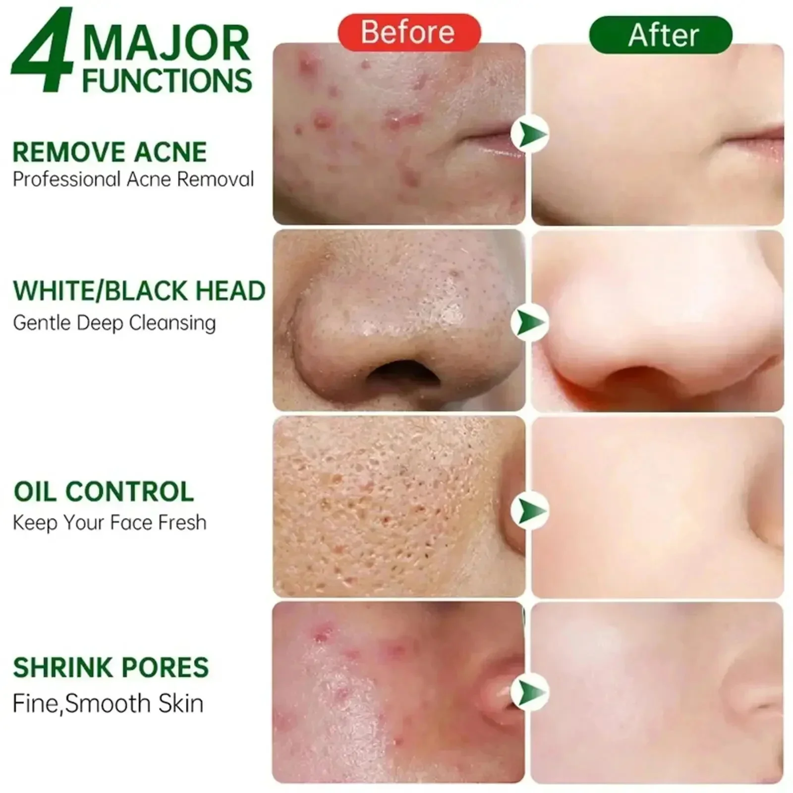 Salicylic Acid Pore Clearing C - Salicylic Acid Blackhead Remover บทวิจารณ์และราคา