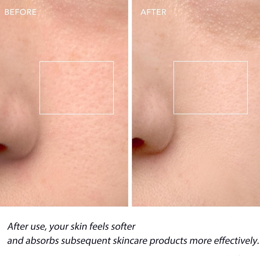 แปรงทำความสะอาดผิวหน้า, เครื่อ - Silicone Face Scrubber Electric บทวิจารณ์และราคา