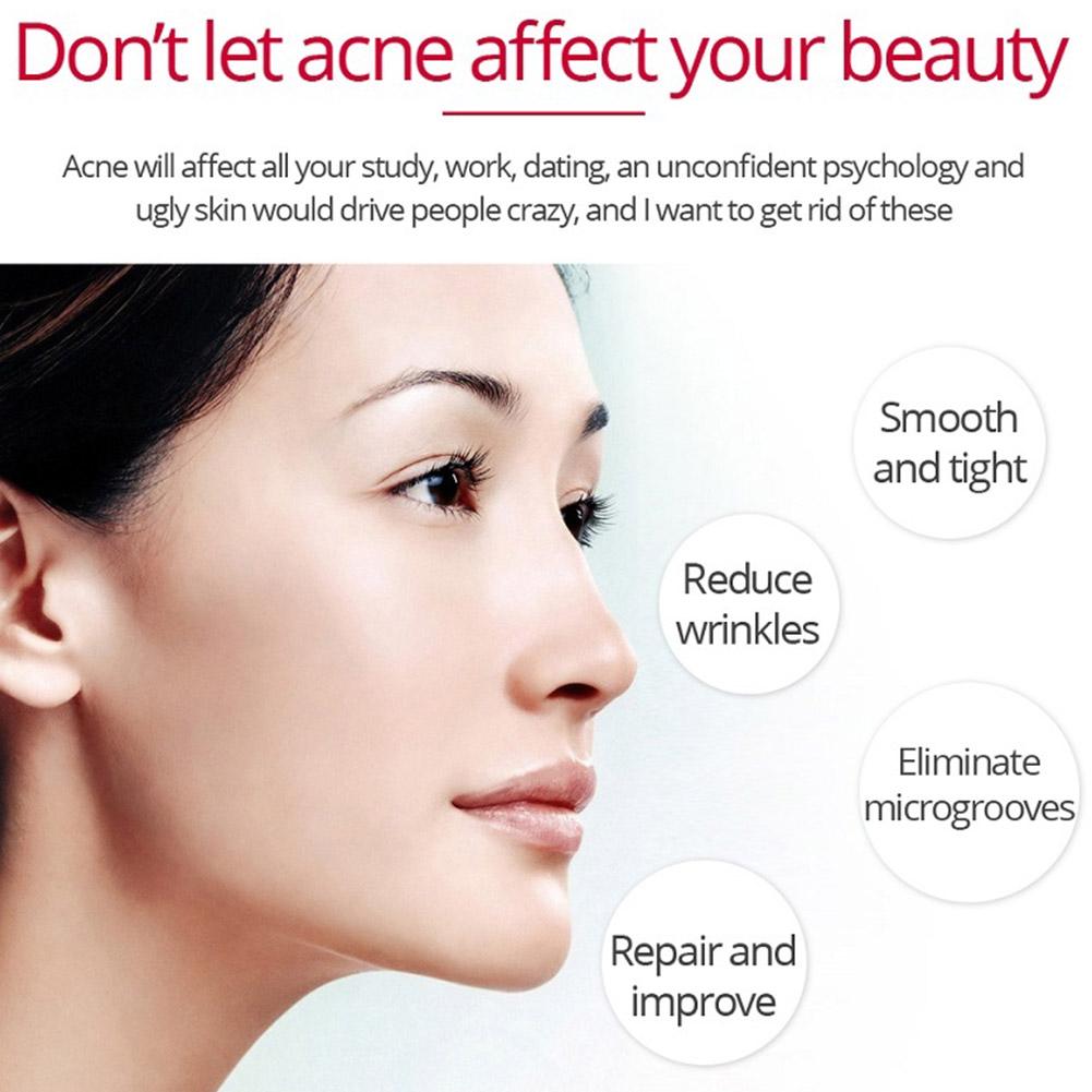Retinol Lifting Firming ครีมลบ - Retinol Anti Wrinkle Cream บทวิจารณ์และราคา