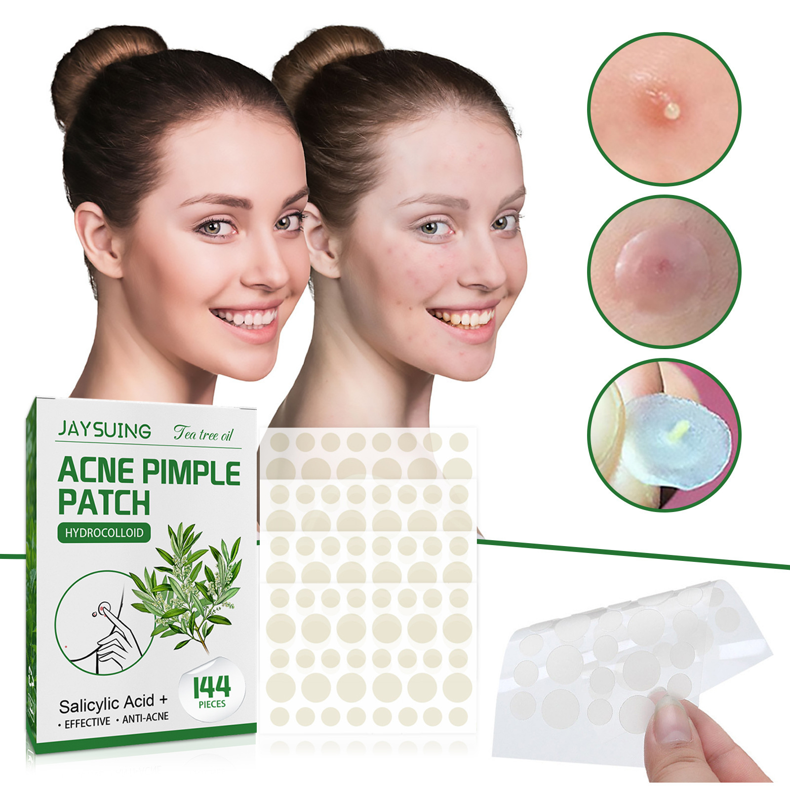 แผ่นแปะสิวไฮโดรคอลลอยด์ - ดูดซ - Hydrocolloid Pimple Patch บทวิจารณ์และราคา