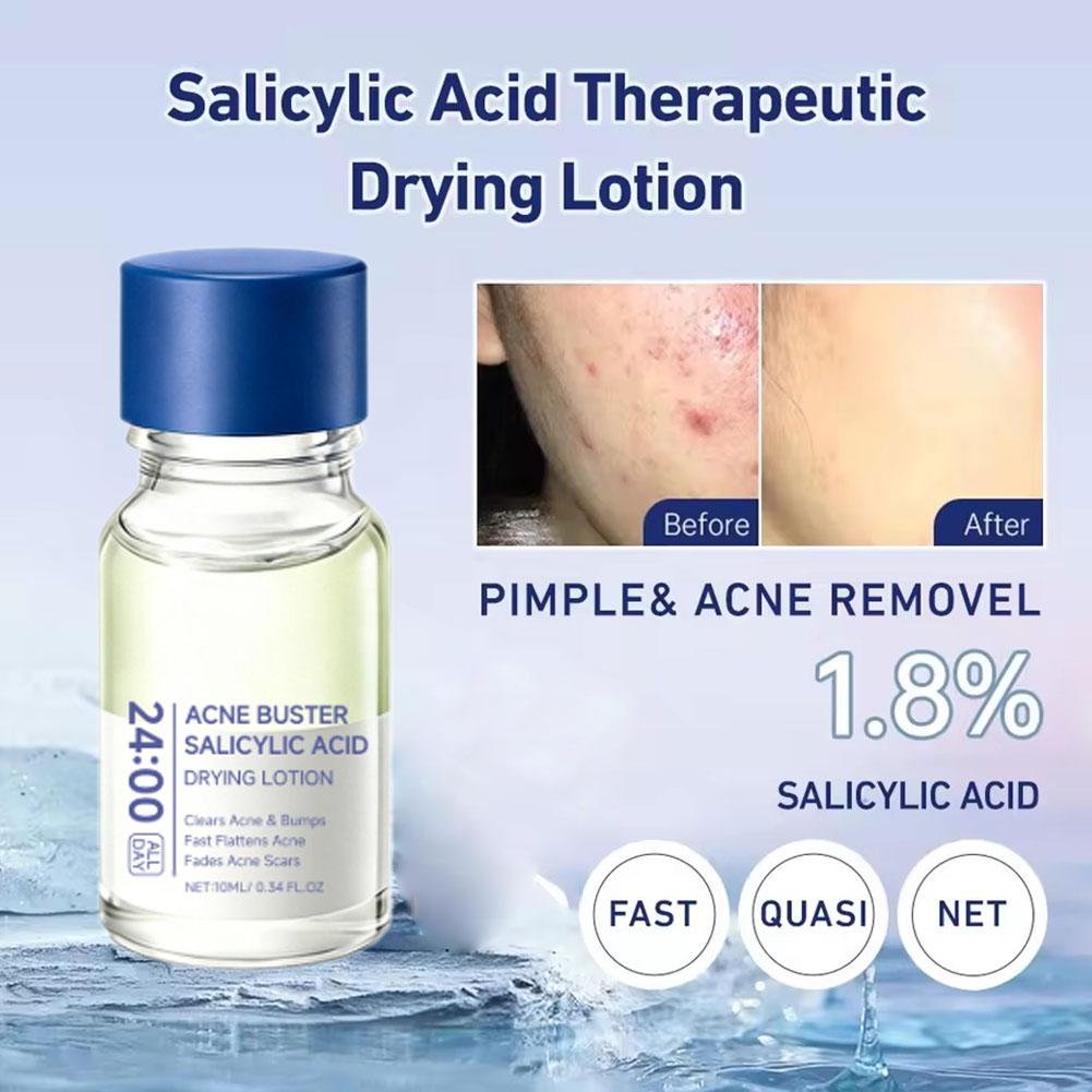 สารสกัดซาลิไซลิก แอซิด กำจัดสิ - Salicylic Acid Blackhead Remover บทวิจารณ์และราคา